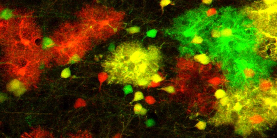 Astrocytes in the mouse brain, labelled using the MADM technique.  Credit: Simon Hippenmeyer / IST Austria