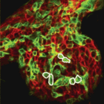 Live-Aufnahme von Stammzellen, die sich zufällig im Brustdrüsengewebe bewegen