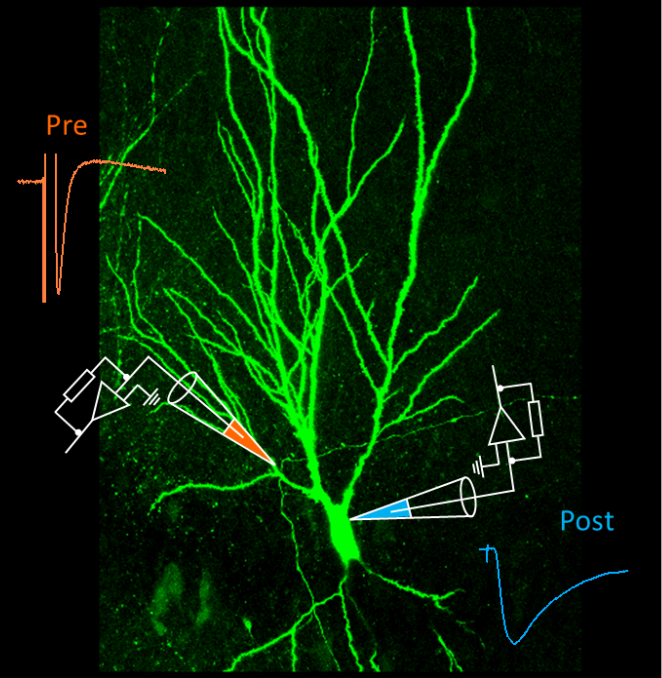 Mossy fiber synapse in the hippocampus, a “smart teacher”.  Image provided by David Vandael and Yuji Okamoto, modified from Vandael et al., Nature Protocols, in press. ©IST Austria