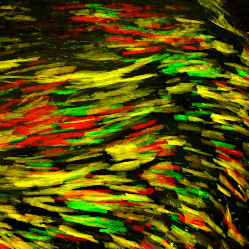 Heart cells labeled with MADM