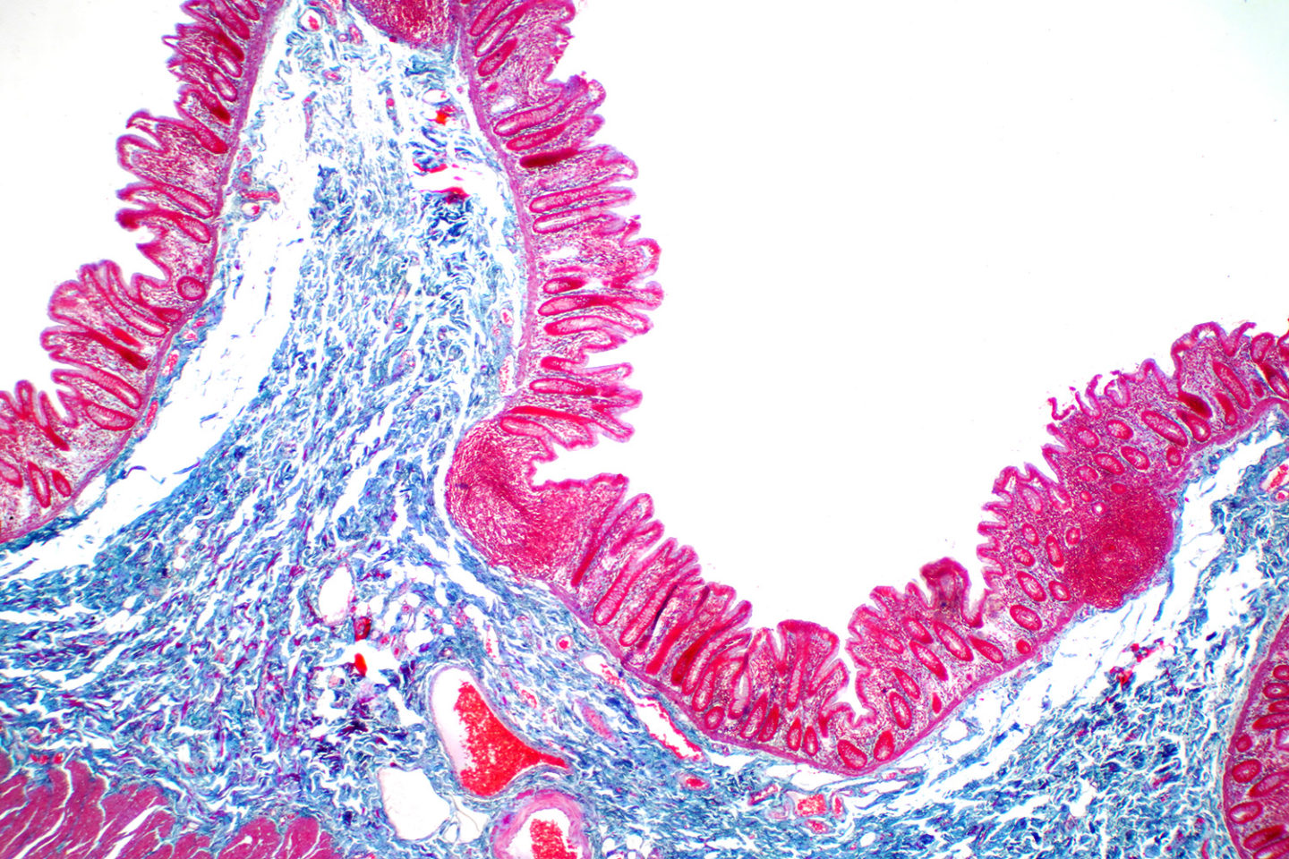 Intestinal Villi And Crypts Photo (c) Shutterstock Small
