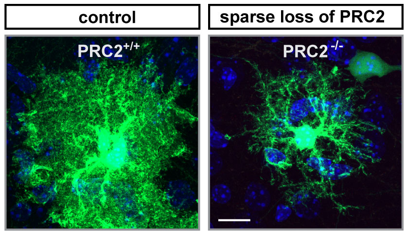 High resolution images of individual cortical astrocytes from 3 week old normal control mice (left) and mice where only single stem cells lack PRC2 (right). The image was acquired at a ZEISS LSM800 confocal microscope by Nicole Amberg.