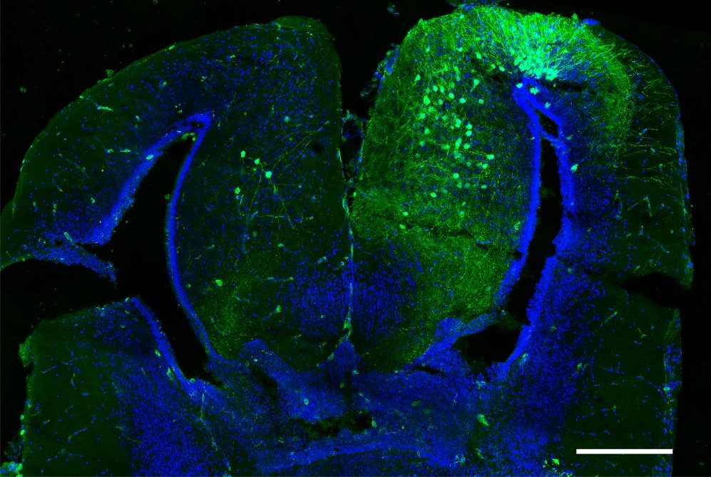 AAV-mediated labeling of neurons