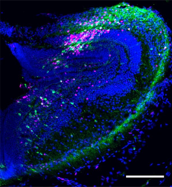 Developing neurons