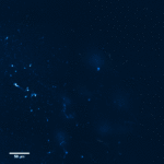Human CA3 pyramidal neurons recorded in a patient tissue sample.