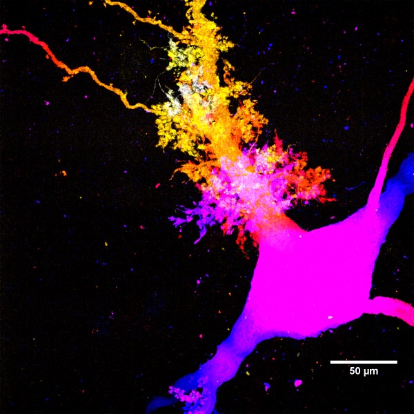 Postsynaptic structures on a human hippocampal neuron from patient tissue.