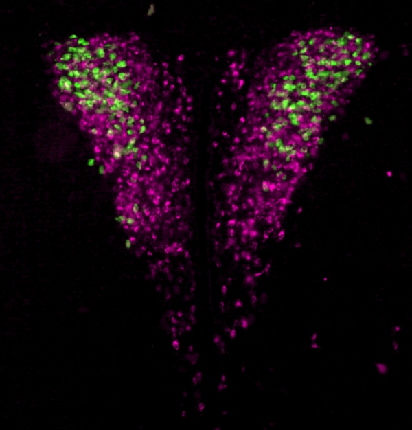 Hypothalamische Neuronen, die die Hormonausschüttung steuern (Magenta), und solche, die speziell die Ausschüttung des Stresshormons Cortisol steuern (grün).