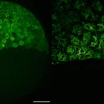 Das Protein Keratin wurde mit grün fluoreszierendem Farbstoff markiert. Der Prozess ist auf der linken Aufnahme aus größerer Distanz (100 µm) und auf der rechten Aufnahme in einer vergrößerten Ansicht (Maßstab: 25 µm) dargestellt.