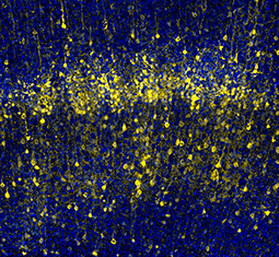 feature image