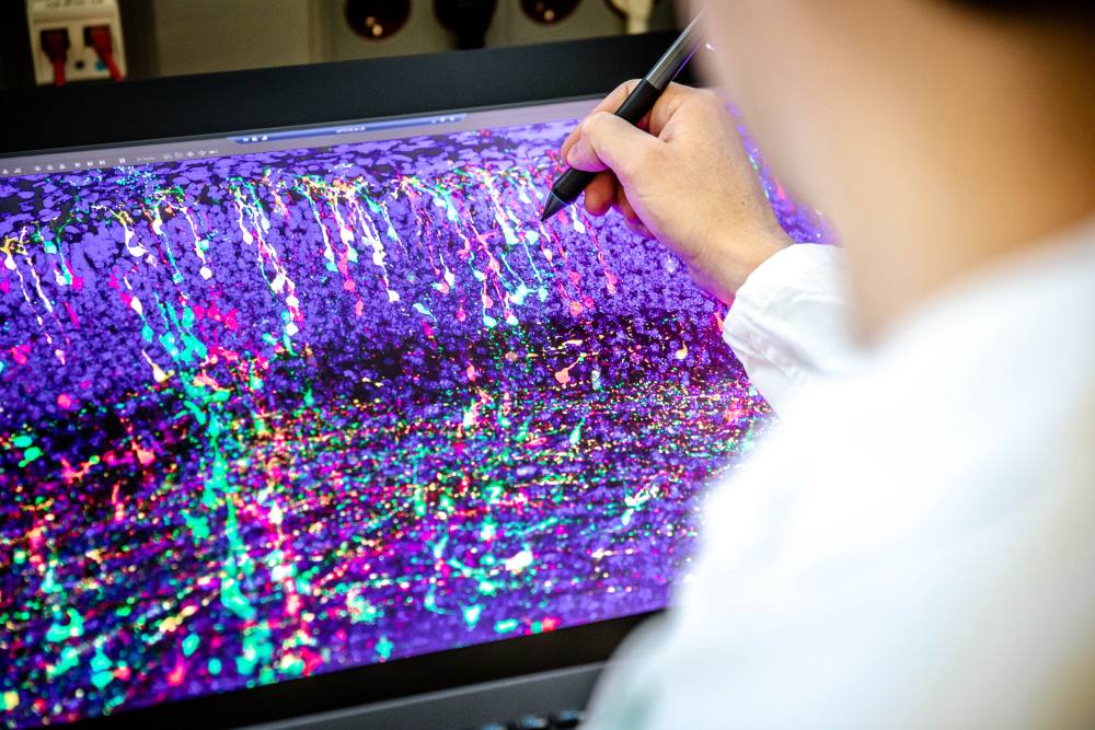 MADM-Technik. Mithilfe von MADM (Mosaic Analysis with Double Markers) lassen sich Neuronen in vivo (im lebenden Organismus), in der Maus, verfolgen und ihre Abstammung rekonstruieren.